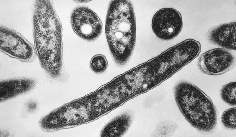 New diagnoses slow in NYC Legionnaires’ disease outbreak; source still unclear