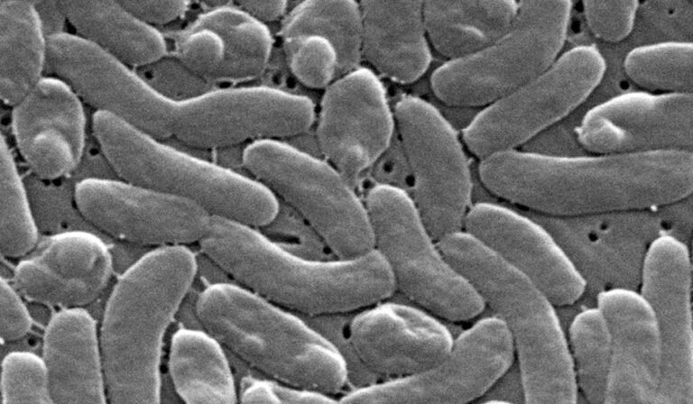 Flesh-eating bacteria kills 5 in Louisiana as cases outpace 10-year average